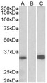 KCNIP3 / Dream / Calsenilin Antibody - KCNIP3 antibody HEK293 lysate (10 ug protein in RIPA buffer) overexpressing Human KCNIP3 with C-terminal MYC tag probed with (1 ug/ml) in Lane A and probed with anti-MYC Tag (1/1000) in lane C. Mock-transfected HEK293 probed with (1 mg/ml) in Lane B. Primary incubations were for 1 hour. Detected by chemiluminescence.