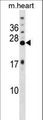 KCNIP4 / KCHIP4 Antibody - KCNIP4 Antibody western blot of mouse heart tissue lysates (35 ug/lane). The KCNIP4 antibody detected the KCNIP4 protein (arrow).