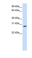 KCNIP4 / KCHIP4 Antibody - KCNIP4 antibody Western blot of Fetal Muscle lysate. This image was taken for the unconjugated form of this product. Other forms have not been tested.