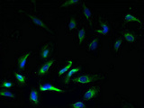 KCNJ1 / ROMK Antibody - Immunofluorescent analysis of Hela cells using KCNJ1 Antibody at dilution of 1:100 and Alexa Fluor 488-congugated AffiniPure Goat Anti-Rabbit IgG(H+L)