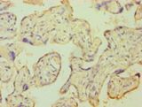 KCNJ10 / SESAME / KIR4.1 Antibody - Immunohistochemistry of paraffin-embedded human placenta tissue using antibody at 1:100 dilution.  This image was taken for the unconjugated form of this product. Other forms have not been tested.