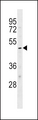 KCNJ10 / SESAME / KIR4.1 Antibody - KCNJ10 Antibody western blot of HL-60 cell line lysates (35 ug/lane). The KCNJ10 antibody detected the KCNJ10 protein (arrow).