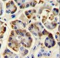 KCNJ6 / GIRK2 Antibody - KCNJ6 Antibody immunohistochemistry of formalin-fixed and paraffin-embedded human pancreas tissue followed by peroxidase-conjugated secondary antibody and DAB staining.