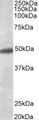 KCNJ6 / GIRK2 Antibody - KCNJ6 / GIRK2 antibody (0.5µg/ml) staining of Human Brain (Substantia Nigra) lysate (35µg protein in RIPA buffer). Primary incubation was 1 hour. Detected by chemiluminescence.