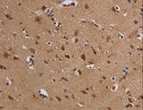 KCNK13 / THIK-1 Antibody - Immunohistochemistry of paraffin-embedded Human brain using KCNK13 Polyclonal Antibody at dilution of 1:50.