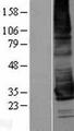 KCNK17 Protein - Western validation with an anti-DDK antibody * L: Control HEK293 lysate R: Over-expression lysate
