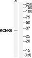 KCNK6 / TWIK-2 Antibody - Western blot analysis of extracts from Jurkat cells, using KCNK6 antibody.