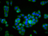 KCNK9 / TASK3 Antibody - Immunofluorescence staining of PC3 cells diluted at 1:166, counter-stained with DAPI. The cells were fixed in 4% formaldehyde, permeabilized using 0.2% Triton X-100 and blocked in 10% normal Goat Serum. The cells were then incubated with the antibody overnight at 4°C.The Secondary antibody was Alexa Fluor 488-congugated AffiniPure Goat Anti-Rabbit IgG (H+L).