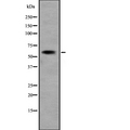KCNN1 Antibody - Western blot analysis of KCNN1 expression in Jurkat cells lysate. The lane on the left is treated with the antigen-specific peptide.