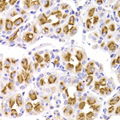 KCNN3 / SK3 Antibody - Immunohistochemistry of paraffin-embedded Human gastric tissue.