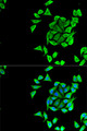 KCNN3 / SK3 Antibody - Immunofluorescence analysis of U2OS cells using KCNN3 antibody. Blue: DAPI for nuclear staining.