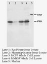 KCNN4 / KCa3.1 Antibody -  This image was taken for the unconjugated form of this product. Other forms have not been tested.