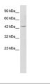 KCNQ1 / KVLQT1 Antibody - Jurkat Cell Lysate.  This image was taken for the unconjugated form of this product. Other forms have not been tested.