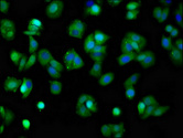KCNQ3 Antibody - Immunofluorescence staining of HepG2 cells at a dilution of 1:100, counter-stained with DAPI. The cells were fixed in 4% formaldehyde, permeabilized using 0.2% Triton X-100 and blocked in 10% normal Goat Serum. The cells were then incubated with the antibody overnight at 4 °C.The secondary antibody was Alexa Fluor 488-congugated AffiniPure Goat Anti-Rabbit IgG (H+L) .