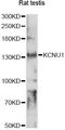 KCNU1 / KCNMC1 Antibody - Western blot analysis of extracts of rat testis, using KCNU1 antibody at 1:1000 dilution. The secondary antibody used was an HRP Goat Anti-Rabbit IgG (H+L) at 1:10000 dilution. Lysates were loaded 25ug per lane and 3% nonfat dry milk in TBST was used for blocking. An ECL Kit was used for detection and the exposure time was 90s.