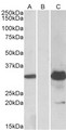 KCTD11 Antibody - HEK293 lysate (10ug protein in RIPA buffer) overexpressing Human KCTD11 with DYKDDDDK tag probed with (1.0ug/ml) in Lane A and probed with anti-DYKDDDDK Tag (1/5000) in lane C. Mock-transfected HEK293 probed (1mg/ml) in Lane B. Primar