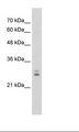 KCTD11 Antibody - Jurkat Cell Lysate.  This image was taken for the unconjugated form of this product. Other forms have not been tested.