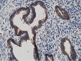 KCTD14 Antibody - IHC of paraffin-embedded Human endometrium tissue using anti-KCTD14 mouse monoclonal antibody. (Heat-induced epitope retrieval by 10mM citric buffer, pH6.0, 100C for 10min).