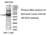 KCTD16 Antibody