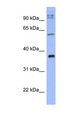 KCTD4 Antibody - KCTD4 antibody Western blot of THP-1 cell lysate. This image was taken for the unconjugated form of this product. Other forms have not been tested.