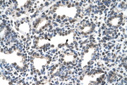 KCTD6 Antibody - KCTD6 antibody ARP35425_T100-NP_699162-KCTD6(potassium channel tetramerisation domain containing 6) Antibody IHC of formalin-fixed, paraffin-embedded human Lung. Positive label: Alveolar cells indicated with arrows. Antibody concentration 16 0 mg m1. Magnification 400X.  This image was taken for the unconjugated form of this product. Other forms have not been tested.