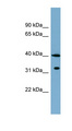 KCTD9 Antibody - KCTD9 antibody Western blot of MCF7 cell lysate. This image was taken for the unconjugated form of this product. Other forms have not been tested.