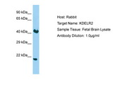 KDELR2 Antibody -  This image was taken for the unconjugated form of this product. Other forms have not been tested.