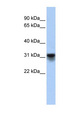 KDELR3 Antibody - KDELR3 antibody Western blot of Fetal Heart lysate. This image was taken for the unconjugated form of this product. Other forms have not been tested.