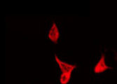 KDELR3 Antibody - Staining NIH-3T3 cells by IF/ICC. The samples were fixed with PFA and permeabilized in 0.1% Triton X-100, then blocked in 10% serum for 45 min at 25°C. The primary antibody was diluted at 1:200 and incubated with the sample for 1 hour at 37°C. An Alexa Fluor 594 conjugated goat anti-rabbit IgG (H+L) Ab, diluted at 1/600, was used as the secondary antibody.