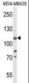 KDM4B / JMJD2B Antibody - Western blot of JMJD2B-T305 in MDA-MB435 cell line lysates (35 ug/lane). JMJD2B (arrow) was detected using the purified antibody.