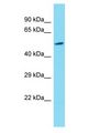 KDM4E Antibody - KDM4E antibody Western Blot of 721_B. Antibody dilution: 1 ug/ml.  This image was taken for the unconjugated form of this product. Other forms have not been tested.