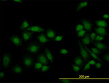 KDM5B / JARID1B Antibody - Immunofluorescence of monoclonal antibody to JARID1B on HeLa cell. [antibody concentration 10 ug/ml].