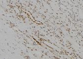 KDM5D / JARID1D Antibody - 1:100 staining human kidney tissue by IHC-P. The sample was formaldehyde fixed and a heat mediated antigen retrieval step in citrate buffer was performed. The sample was then blocked and incubated with the antibody for 1.5 hours at 22°C. An HRP conjugated goat anti-rabbit antibody was used as the secondary.