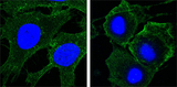 KDR / VEGFR2 / FLK1 Antibody - Confocal immunofluorescence of HeLa (left) and HepG2 (right) cells using KDR mouse monoclonal antibody (green). Blue: DRAQ5 fluorescent DNA dye.