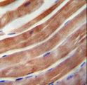 KEAP1 Antibody - KEAP1 antibody immunohistochemistry of formalin-fixed and paraffin-embedded human skeletal muscle followed by peroxidase-conjugated secondary antibody and DAB staining.