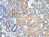KEAP1 Antibody - KEAP1 antibody ARP34728_T100-NP_987096-KEAP1(kelch-like ECH-associated protein 1) Antibody was used in IHC to stain formalin-fixed, paraffin-embedded human kidney.  This image was taken for the unconjugated form of this product. Other forms have not been tested.