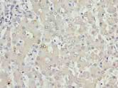 KHDC1 / C6orf148 Antibody - Immunohistochemistry of paraffin-embedded human liver tissue using antibody at dilution of 1:100.