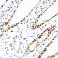 KHDRBS2 / SLM-1 Antibody - Immunohistochemistry of paraffin-embedded human stomach tissue.