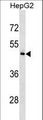 KHDRBS3 / SLM2 Antibody - KHDRBS3 Antibody western blot of HepG2 cell line lysates (35 ug/lane). The KHDRBS3 antibody detected the KHDRBS3 protein (arrow).
