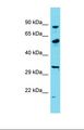 KHSRP / FBP2 Antibody - Western blot of Human Thyroid Tumor. KHSRP antibody dilution 1.0 ug/ml.  This image was taken for the unconjugated form of this product. Other forms have not been tested.