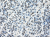 KIAA0153 / TTLL12 Antibody - Immunohistochemical staining of paraffin-embedded endometrium tissue using anti-TTLL12 mouse monoclonal antibody. (Dilution 1:50).