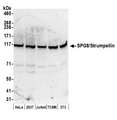 KIAA0196 Antibody - Detection of human and mouse SPG8/Strumpellin by western blot. Samples: Whole cell lysate (50 µg) from HeLa, HEK293T, Jurkat, mouse TCMK-1, and mouse NIH 3T3 cells prepared using NETN lysis buffer. Antibody: Affinity purified rabbit anti-SPG8/Strumpellin antibody used for WB at 0.1 µg/ml. Detection: Chemiluminescence with an exposure time of 3 minutes.