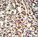 KIAA0226 / RUBICON Antibody - Formalin-fixed and paraffin-embedded human lymph with BARON Antibody , which was peroxidase-conjugated to the secondary antibody, followed by DAB staining. This data demonstrates the use of this antibody for immunohistochemistry; clinical relevance has not been evaluated.
