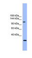 KIAA0226 / RUBICON Antibody - KIAA0226 antibody Western blot of Placenta lysate. This image was taken for the unconjugated form of this product. Other forms have not been tested.