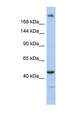 KIAA0284 Antibody - KIAA0284 antibody Western blot of Fetal Muscle lysate. This image was taken for the unconjugated form of this product. Other forms have not been tested.