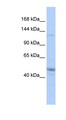 KIAA0319L Antibody - KIAA0319L antibody Western blot of MCF7 cell lysate. This image was taken for the unconjugated form of this product. Other forms have not been tested.