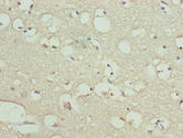 KIAA0319L Antibody - Immunohistochemistry of paraffin-embedded human brain tissue using KIAA0319L Antibody at dilution of 1:100