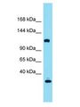 KIAA0355 Antibody - KIAA0355 antibody Western Blot of Fetal Liver. Antibody dilution: 1 ug/ml.  This image was taken for the unconjugated form of this product. Other forms have not been tested.