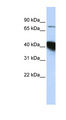 KIAA0427 / CTIF Antibody - CTIF / KIAA0427 antibody Western blot of HepG2 cell lysate. This image was taken for the unconjugated form of this product. Other forms have not been tested.