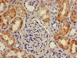 KIAA0467 / SZT2 Antibody - Immunohistochemistry of paraffin-embedded human kidney tissue using SZT2 Antibody at dilution of 1:100